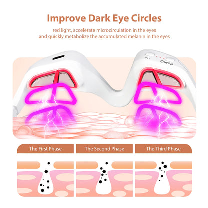 LED Eye Massage Device – Dark Circle Reducer